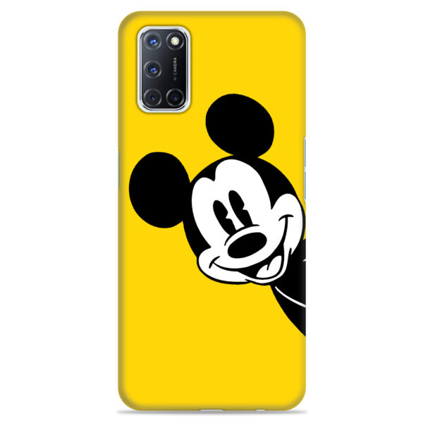 OPPO A72   ( Mickey Design )